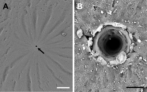 Scanning electron micrographs of a micropyle on the area of the animal pole from fertilized egg of A. cirrhosus. The micropyle (arrow) was surrounded by 15–19 furrow lines of egg envelope in a spoke-like pattern (a). When magnified by scanning electron microscope, the micropyle was funnel shape (b) (Scale bar = A; 100 μm, B; 10 μm)