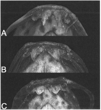 Fig. 1. Lower lip of Lepthoplosternum. (A) L. stellatum, MCP 30651, 38.0 mm SL. (B) L. altamazonicum, MCP 34559, 58.2 mm SL. (C) L. ucamara, MCP 34560, 42.9 mm SL.