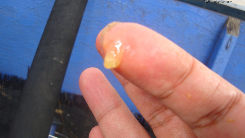 Osteogeneiosus militaris